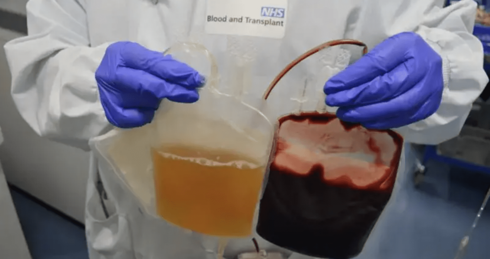 Kent NHS UK-sourced plasma